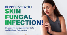 Fungal Skin Infections & their Homoeopathic medicines