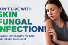 Fungal Skin Infections & their Homoeopathic medicines