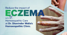 Exploring Eczema: Homoeopathic Medicines for Lasting Relief