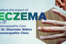 Exploring Eczema: Homoeopathic Medicines for Lasting Relief