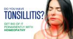 Tackling Tonsillitis with Homoeopathic Remedies