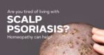 Managing Scalp Psoriasis with Homeopathic Medicines: A Natural Approach to Relief